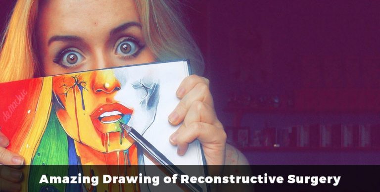 Amazing Drawing of Reconstructive Surgery